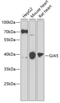 Western blot - GJA5 Polyclonal Antibody 