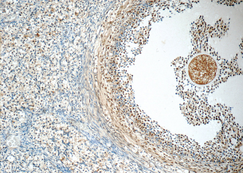 Immunohistochemistry of paraffin-embedded human ovary tissue slide using Catalog No:115108(SENP1 Antibody) at dilution of 1:50 (under 10x lens)