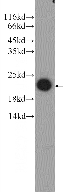 human testis tissue were subjected to SDS PAGE followed by western blot with Catalog No:110532(FATE1 Antibody) at dilution of 1:800
