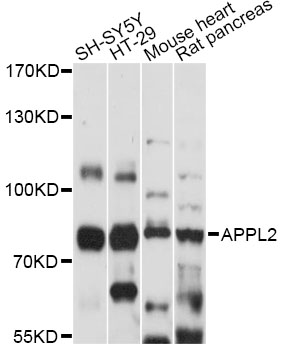 Western blot - APPL2 Polyclonal Antibody 