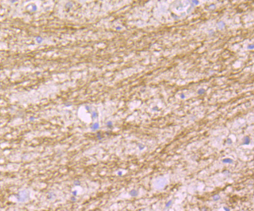 Fig2: Immunohistochemical analysis of paraffin-embedded rat brain tissue using anti-MAL antibody. Counter stained with hematoxylin.