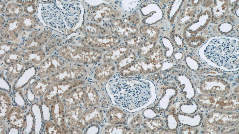 Immunohistochemistry of paraffin-embedded human kidney tissue slide using Catalog No:107929(AKAP11-Specific Antibody) at dilution of 1:50 (under 10x lens)