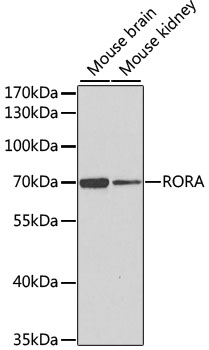 Western blot - RORA Polyclonal Antibody 