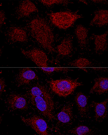 Immunofluorescence - RPL21 Polyclonal Antibody 