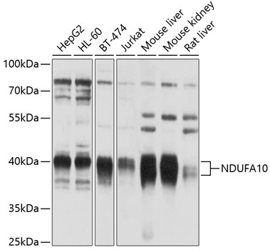 Western blot - NDUFA10 Polyclonal Antibody 