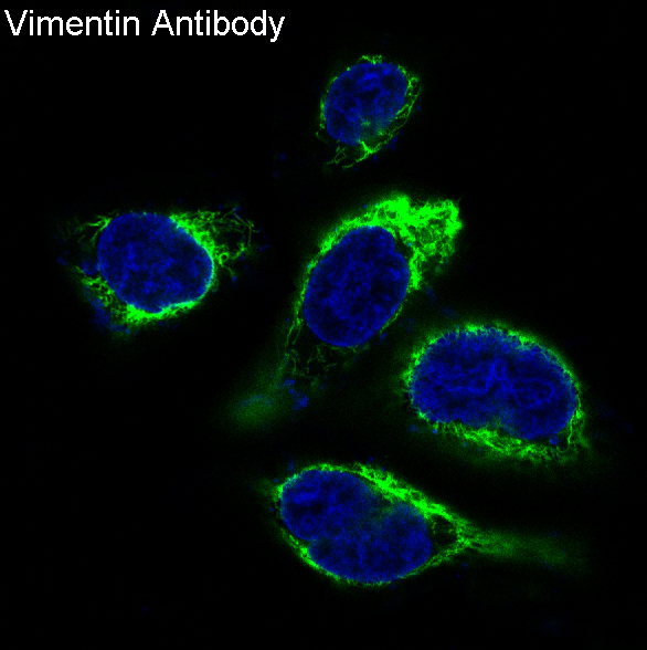 Immunofluorescent analysis of Hela cells, using Vimentin Antibody.