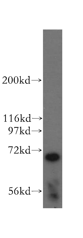 mouse skeletal muscle tissue were subjected to SDS PAGE followed by western blot with Catalog No:112607(MIB2 antibody) at dilution of 1:500