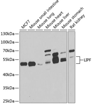 Western blot - LIPF Polyclonal Antibody 