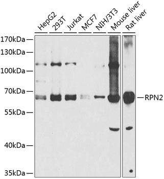 Western blot - RPN2 Polyclonal Antibody 