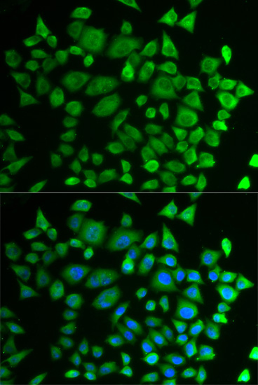 Immunofluorescence - P4HTM Polyclonal Antibody 
