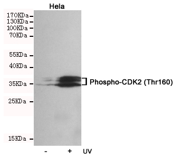 Western blot analysis of extracts from Hela cells, untreated or UV-treated, using Phospho-CDK2 (Thr160)  Rabbit pAb (1:500 diluted).Predicted band size:33kDa.Observed band size:33kDa..