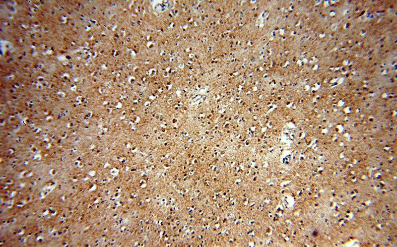 Immunohistochemical of paraffin-embedded human brain using Catalog No:113805(EGLN3 antibody) at dilution of 1:50 (under 10x lens)