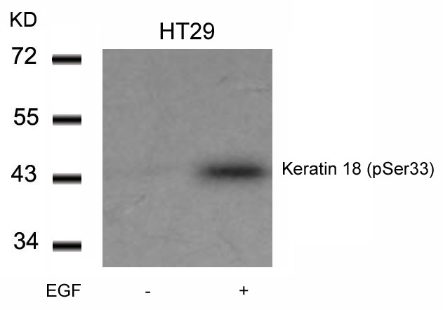 Western blot analysis of extracts from HT29 cells untreated or treated with EGF using Keratin 18 (Phospho-Ser33) Antibody .