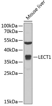 Western blot - LECT1 Polyclonal Antibody 