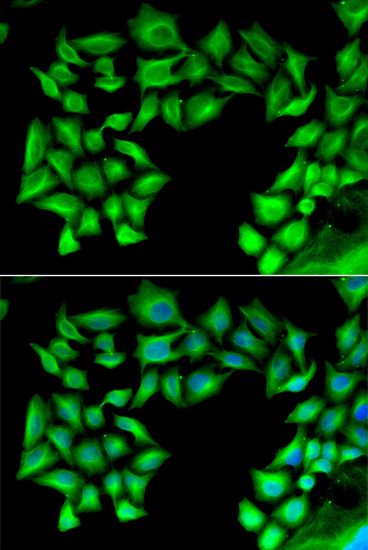 Immunofluorescence - TIMP4 Polyclonal Antibody 