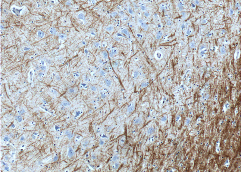 Immunohistochemistry of paraffin-embedded human brain tissue slide using Catalog No:112923(MBP Antibody) at dilution of 1:200 (under 10x lens).