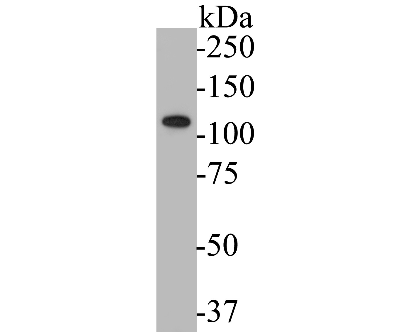 Fig1:; Western blot analysis of KV2.2 on SH-SY5Y cell lysates. Proteins were transferred to a PVDF membrane and blocked with 5% BSA in PBS for 1 hour at room temperature. The primary antibody ( 1/500) was used in 5% BSA at room temperature for 2 hours. Goat Anti-Rabbit IgG - HRP Secondary Antibody (HA1001) at 1:5,000 dilution was used for 1 hour at room temperature.