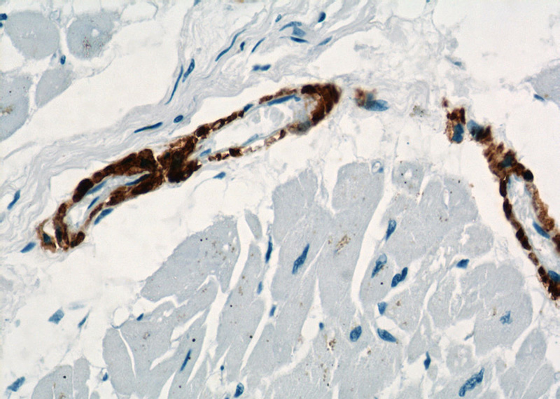 Immunohistochemical of paraffin-embedded human heart using Catalog No:107706(ACTA2 antibody) at dilution of 1:500 (under 40x lens)