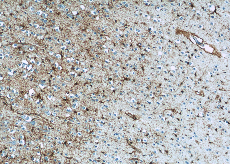 Immunohistochemistry of paraffin-embedded human brain tissue slide using Catalog No:111019(SLC1A3 Antibody) at dilution of 1:50 (under 10x lens)