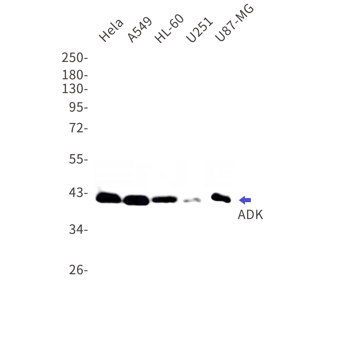 Western blot detection of ADK in Hela,A549,HL-60,U251,U87-MG cell lysates using ADK Rabbit mAb(1:1000 diluted).Predicted band size:41kDa.Observed band size:41kDa.