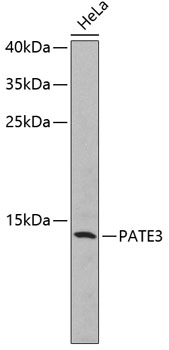 Western blot - PATE3 Polyclonal Antibody 
