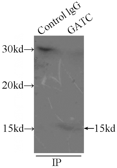 IP Result of anti-GATC (IP:Catalog No:110886, 3ug; Detection:Catalog No:110886 1:500) with mouse liver tissue lysate 12500ug.