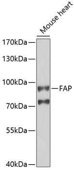 Western blot - FAP Polyclonal Antibody 