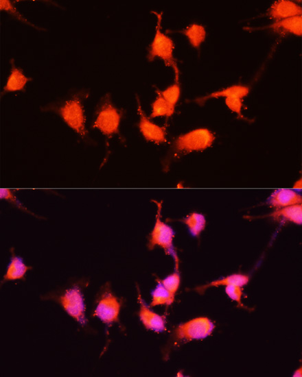Immunofluorescence - NGF Polyclonal Antibody. Immunofluorescence analysis of U-251MG cells using NGF antibody at dilution of 1:100 (40x lens). Blue: DAPI for nuclear staining.
