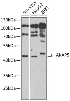 Western blot - AKAP5 Polyclonal Antibody 