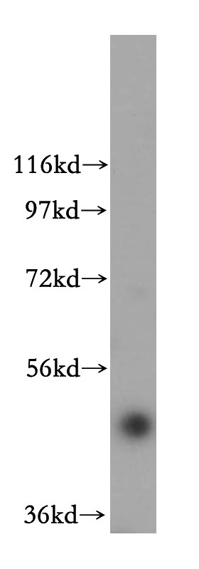 HeLa cells were subjected to SDS PAGE followed by western blot with Catalog No:110552(FBXO3 antibody) at dilution of 1:800
