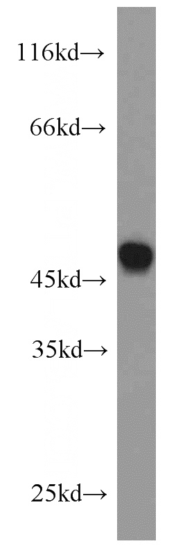HL-60 cells were subjected to SDS PAGE followed by western blot with Catalog No:109634(CX3CR1 antibody) at dilution of 1:800