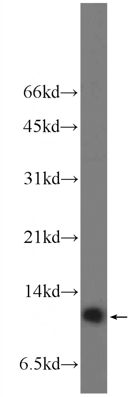 A549 cells were subjected to SDS PAGE followed by western blot with Catalog No:112835(MRPL53 Antibody) at dilution of 1:300