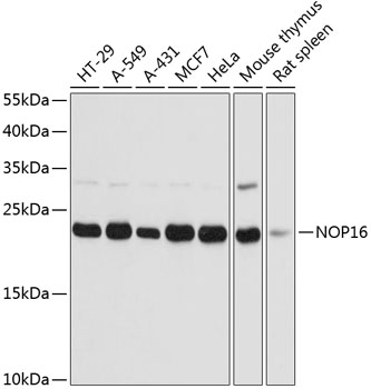 Western blot - NOP16 Polyclonal Antibody 
