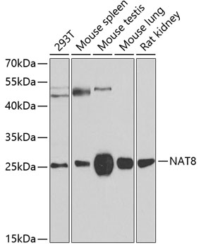 Western blot - NAT8 Polyclonal Antibody 