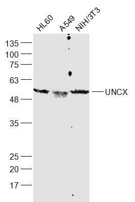 Fig1: Sample:; HL60(Human) Cell Lysate at 30 ug; A549(Human) Cell Lysate at 30 ug; NIH/3T3(Mouse) Cell Lysate at 30 ug; Primary: Anti-UNCX at 1/1000 dilution; Secondary: IRDye800CW Goat Anti-Rabbit IgG at 1/20000 dilution; Predicted band size: 54 kD; Observed band size: 54 kD