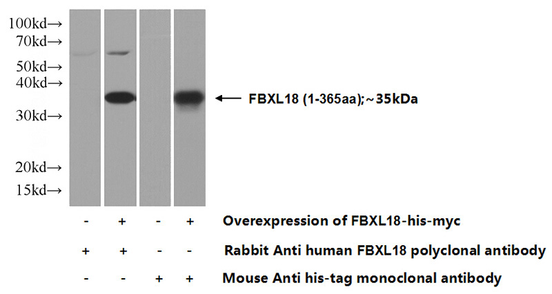 Transfected HEK-293 cells were subjected to SDS PAGE followed by western blot with Catalog No:110545(FBXL18 Antibody) at dilution of 1:1000