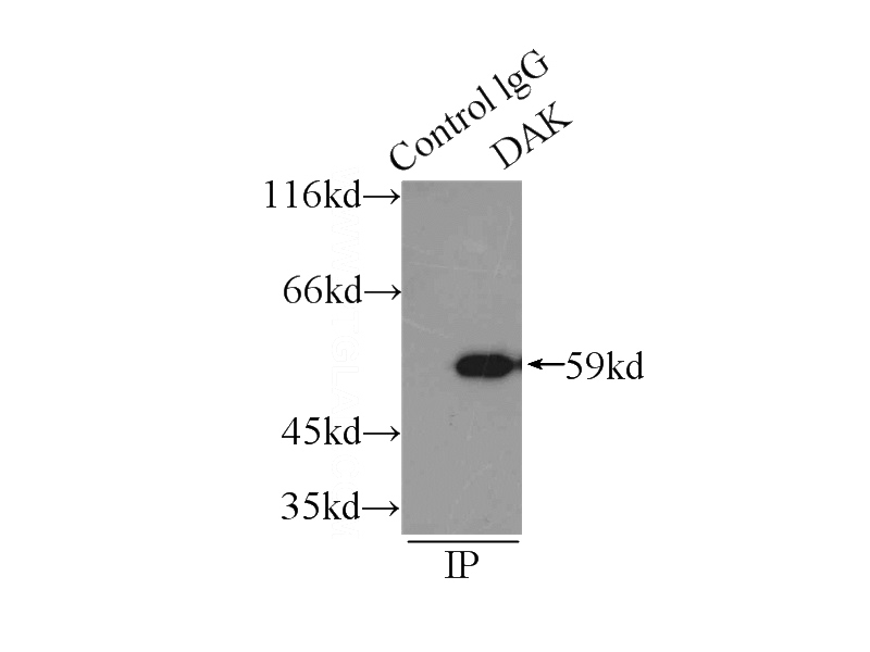IP Result of anti-DAK (IP:Catalog No:109856, 3ug; Detection:Catalog No:109856 1:500) with HeLa cells lysate 2150ug.