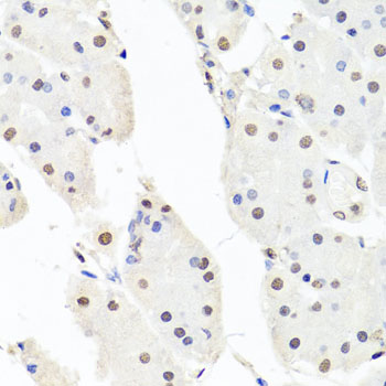 Immunohistochemistry - CHRAC1 Polyclonal Antibody 