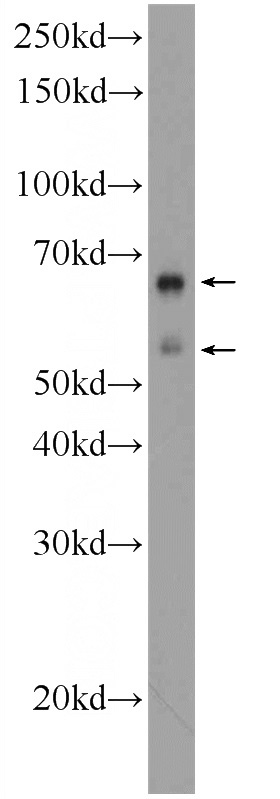 SH-SY5Y cells were subjected to SDS PAGE followed by western blot with Catalog No:110497(EXD1 Antibody) at dilution of 1:600