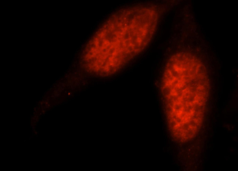 Immunofluorescent analysis of HepG2 cells, using PSME3 antibody Catalog No:114248 at 1:25 dilution and Rhodamine-labeled goat anti-rabbit IgG (red).
