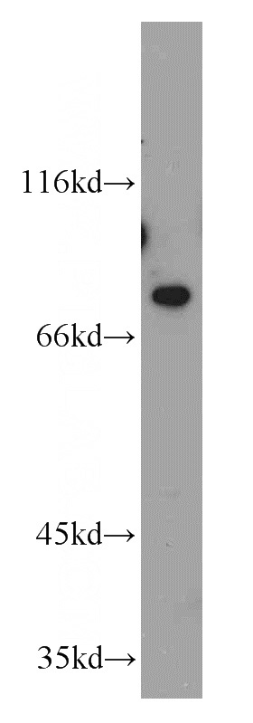 SH-SY5Y cells were subjected to SDS PAGE followed by western blot with Catalog No:113850(PRKCE antibody) at dilution of 1:800