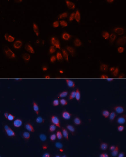 Immunofluorescence - GPC4 Polyclonal Antibody 