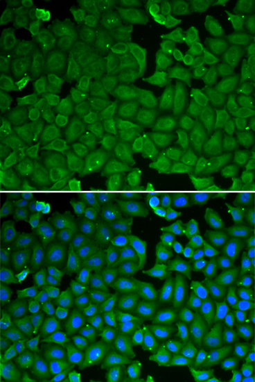 Immunofluorescence - SPINK1 Polyclonal Antibody 