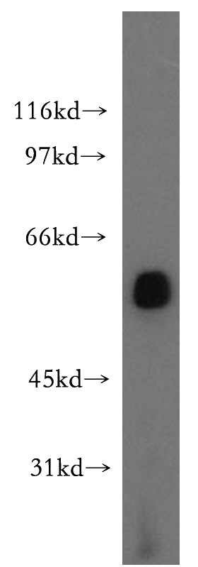 mouse testis tissue were subjected to SDS PAGE followed by western blot with Catalog No:112168(LCAT antibody) at dilution of 1:500