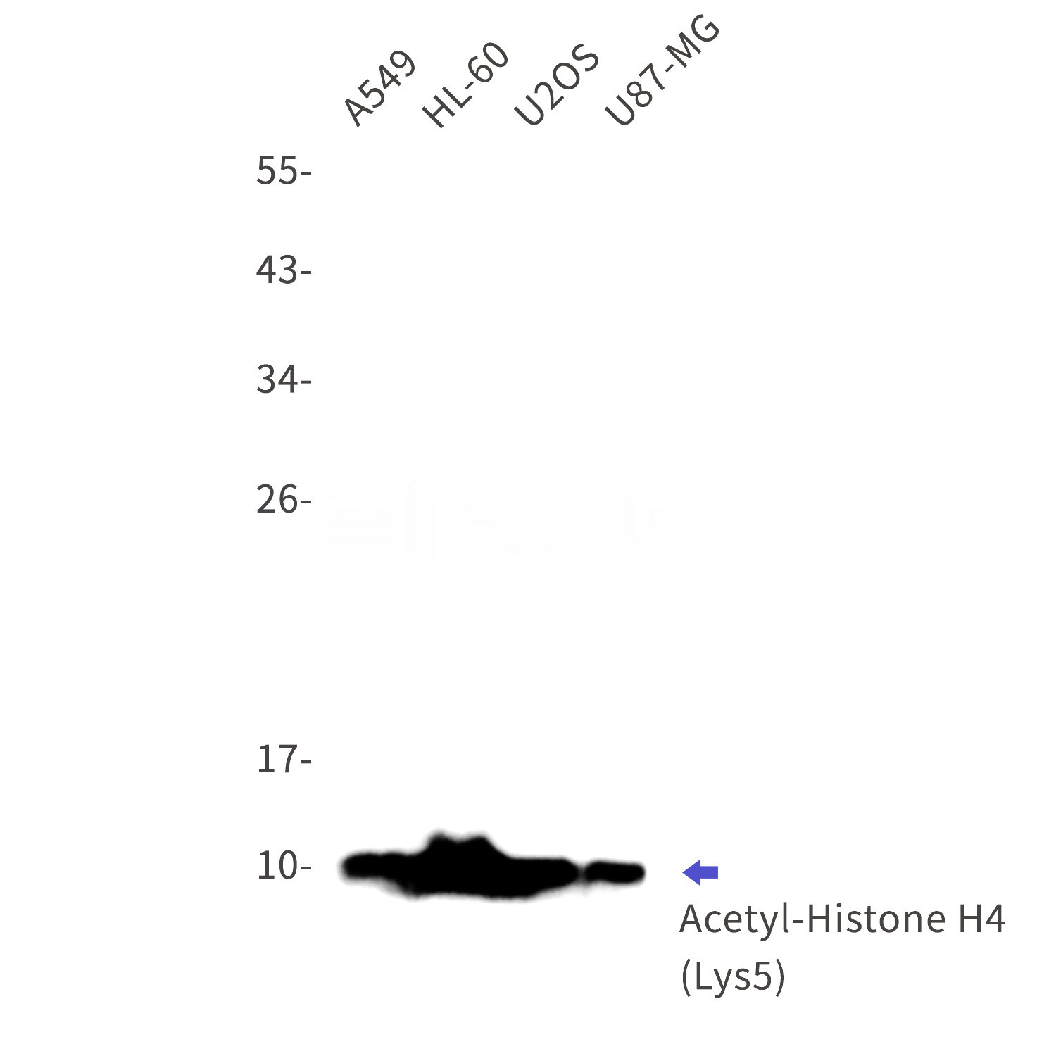 Western blot detection of Acetyl-Histone H4 (Lys5) in A549,HL-60,U2OS,U87-MG cell lysates using Acetyl-Histone H4 (Lys5) Rabbit mAb(1:1000 diluted).Observed band size:11kDa.