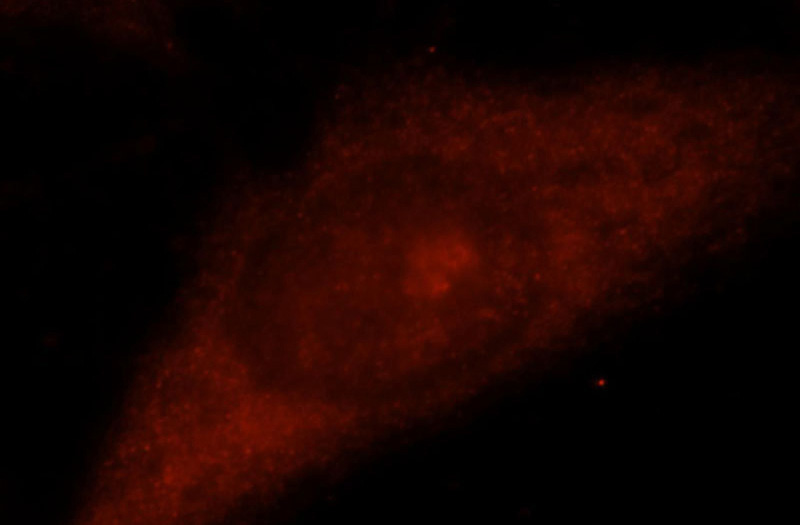 Immunofluorescent analysis of Hela cells, using TSG101 antibody Catalog No:116428 at 1:25 dilution and Rhodamine-labeled goat anti-rabbit IgG (red).