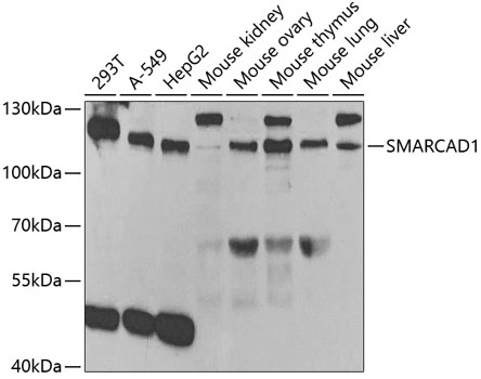 Western blot - SMARCAD1 Polyclonal Antibody 