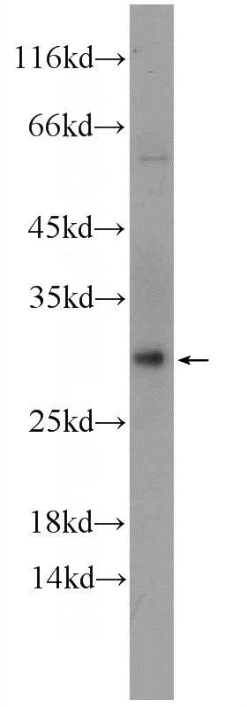 mouse heart tissue were subjected to SDS PAGE followed by western blot with Catalog No:108726(C3orf43 Antibody) at dilution of 1:600