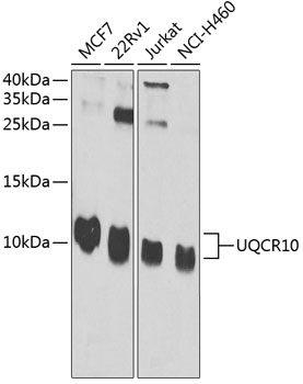 Western blot - UQCR10 Polyclonal Antibody 