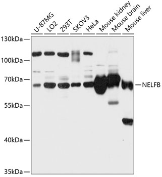 Western blot - NELFB Polyclonal Antibody 